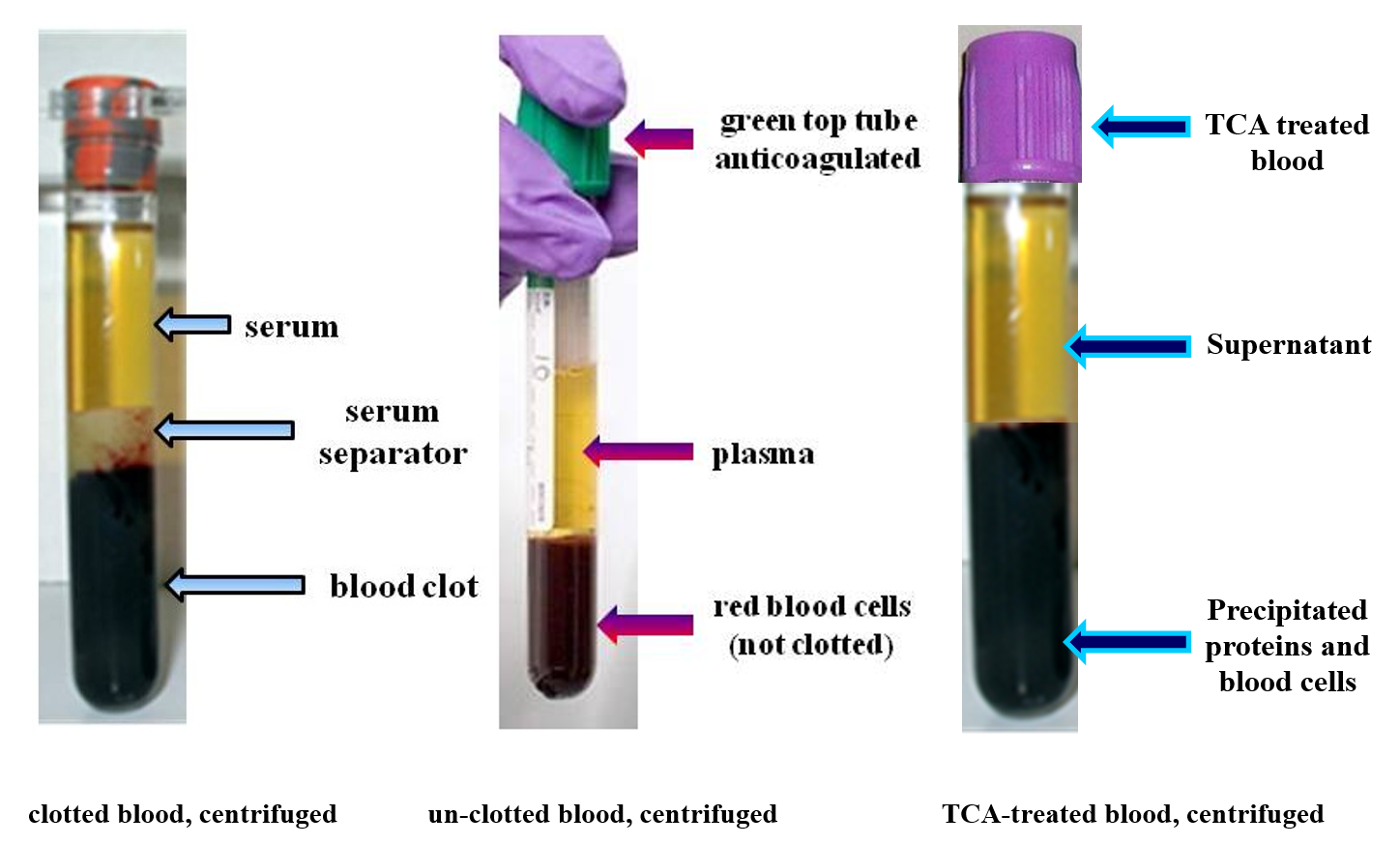 Centrifuged Blood Samples University Medical And Forensic Consultants