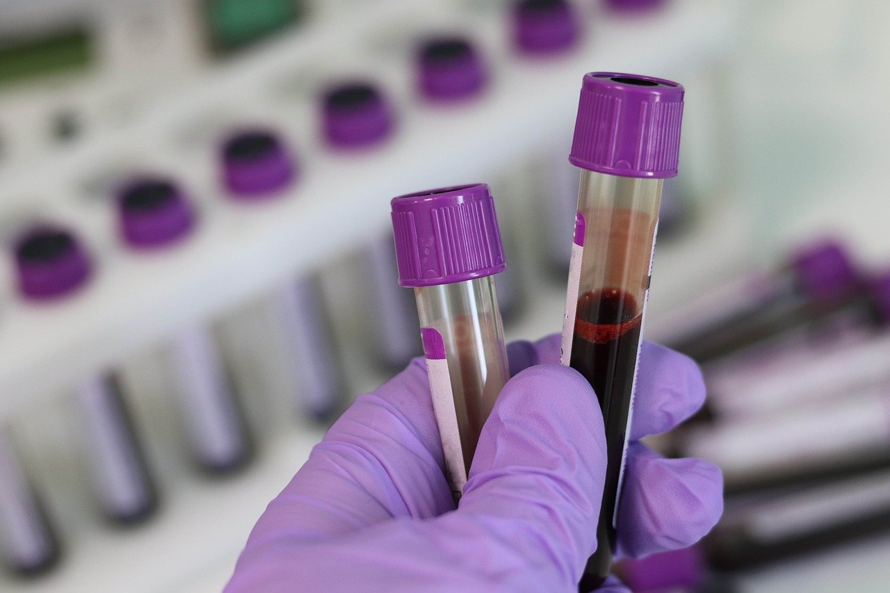 blood ethanol samples